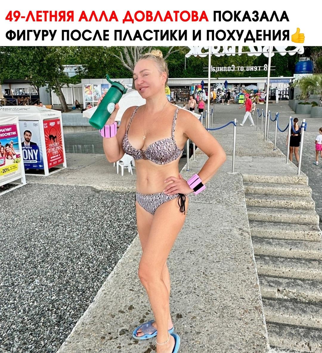 Умеренная пластика это не плохо