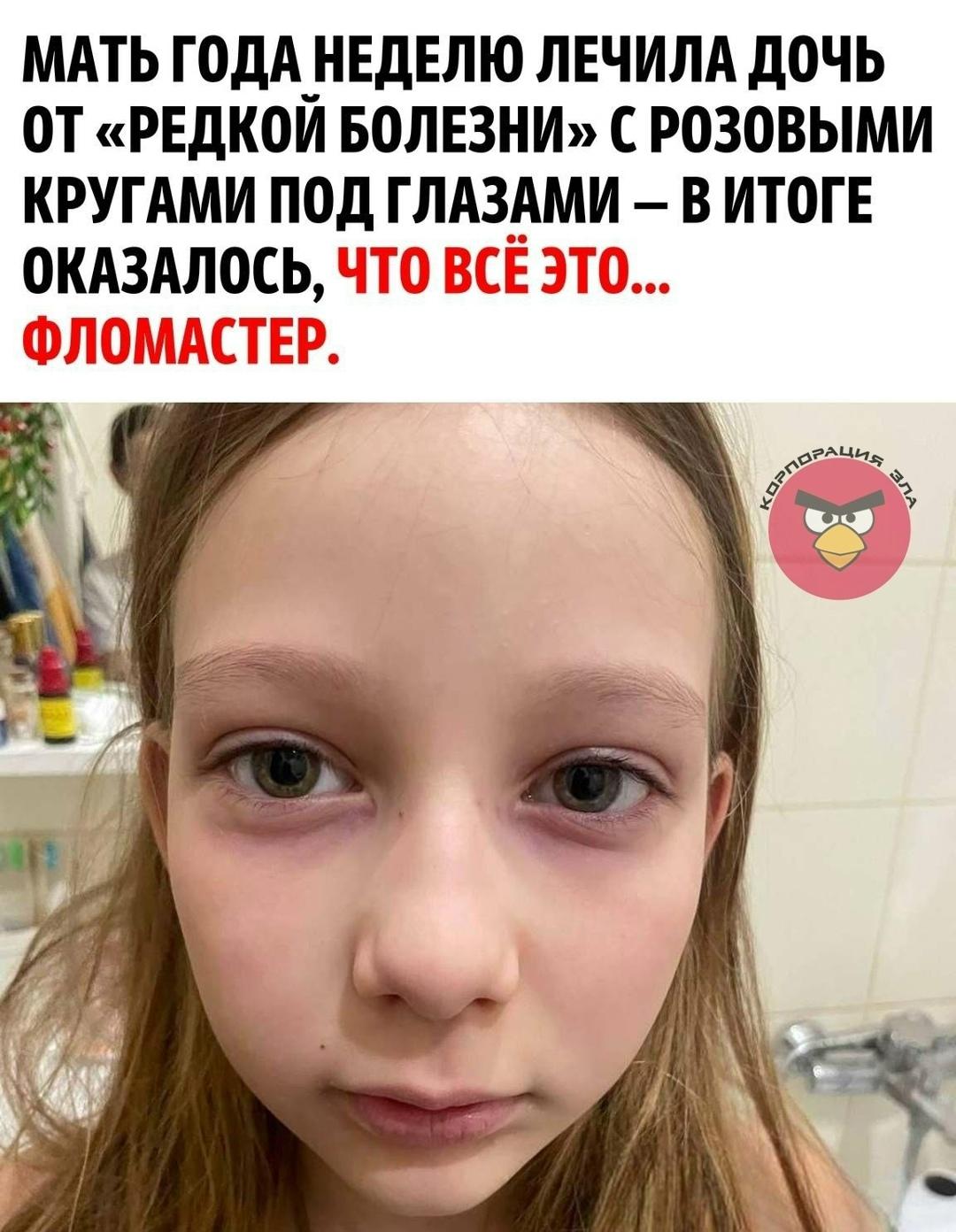 10-летняя Марика из Томска пожаловалась на тошноту и странные покраснения под глазами. Девочку водили по врачам и подозревали редкое заболевание — хромгидроз, при котором потовые железы выделяют пигмент.