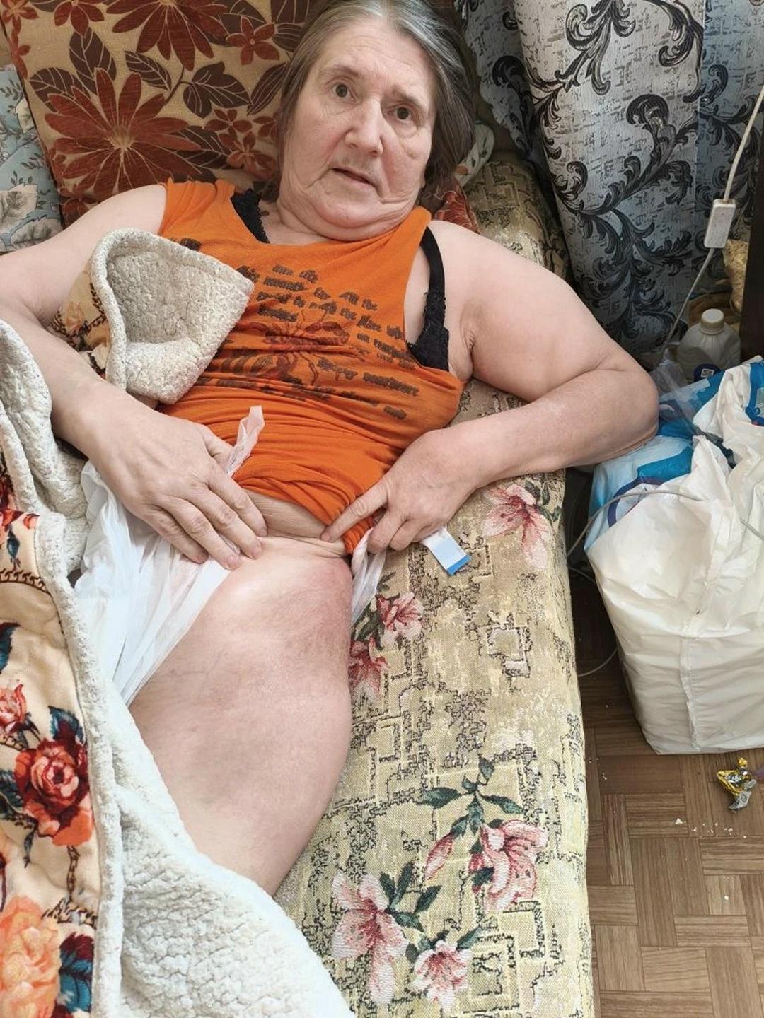 Без квартиры, без родных и без здоровья. Татьяна Николаевна борется за возможность ходить после перелома. Помогите ей!