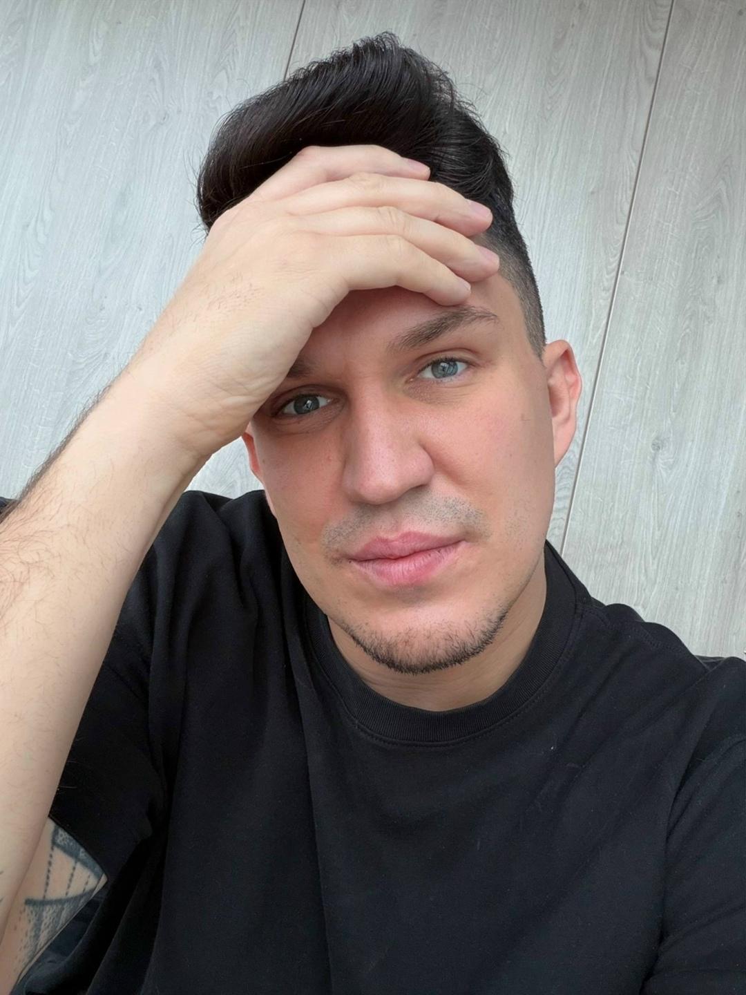 Диме Масленникову вместо запланированных четырёх зубов пришлось удалить шесть 😳