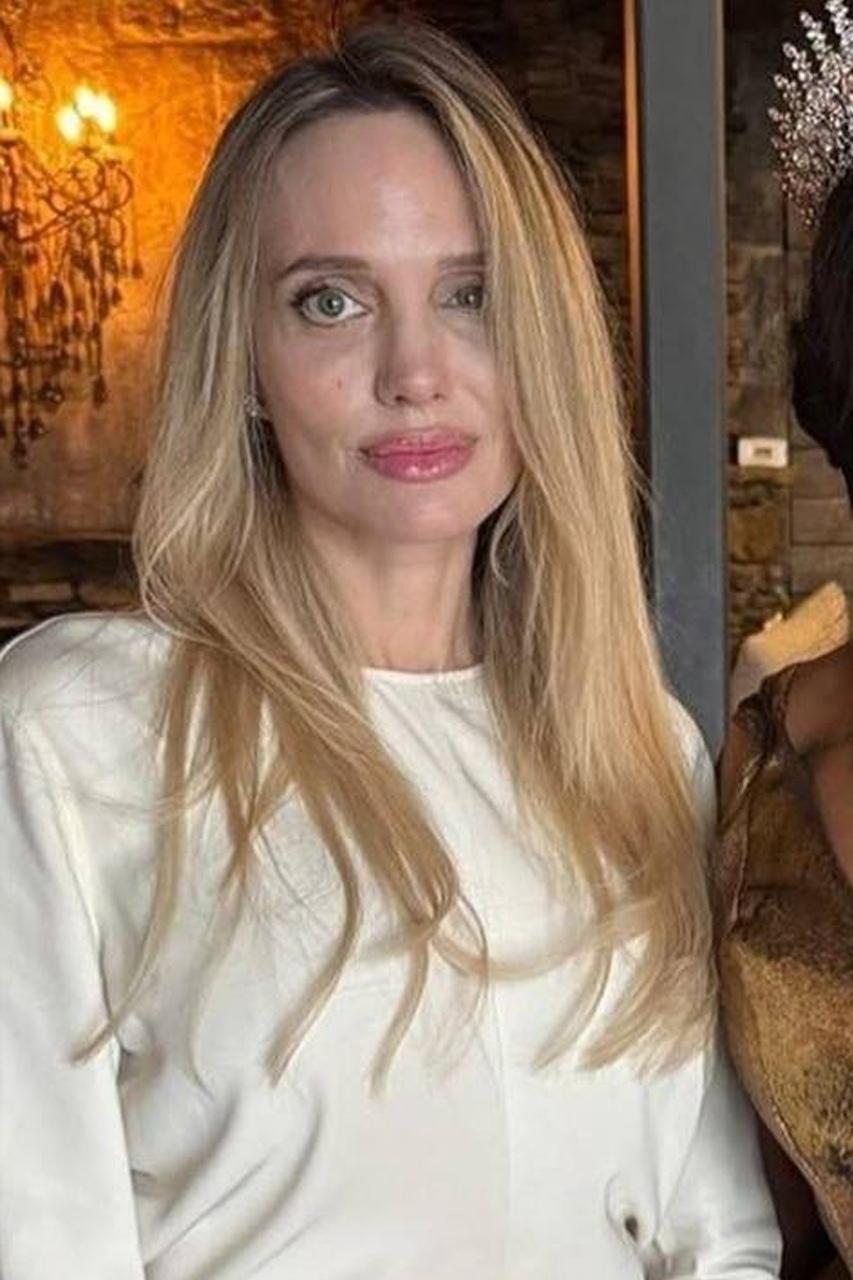 Фанаты Анджелины Джоли подозревают у неё паралич лицевого нерва.