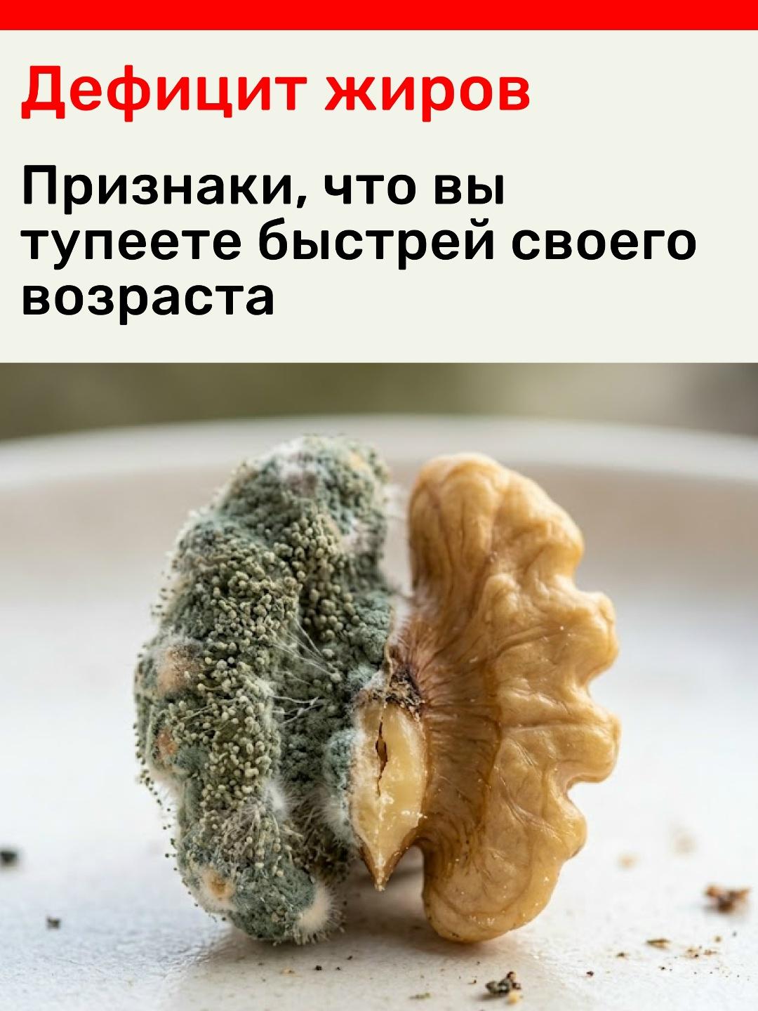 ⚠️ Посмотрите на это фото грецкого ореха, который анатомически точь-в-точь повторяет форму человеческого мозга. Одна его половина здорова, а вторая — покрылась склизкой серой плесенью и заживо гниет.