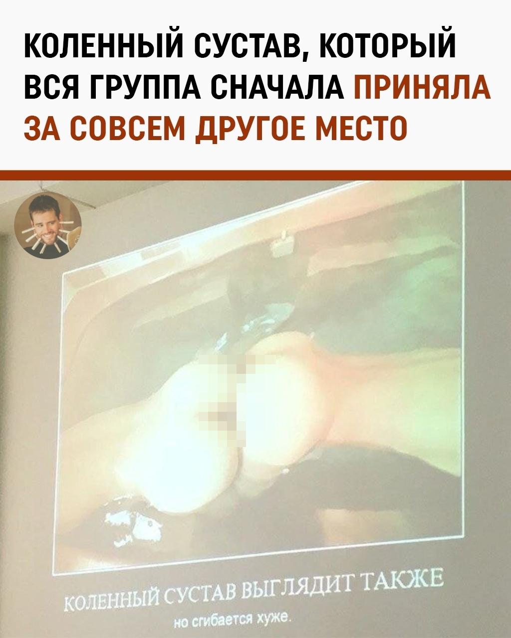 Когда женские ягодицы внезапно стали коленным суставом