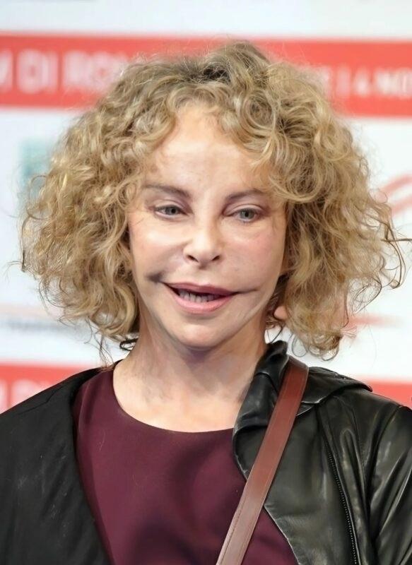 Когда-то она была любимицей миллионов благодаря необычной внешности, но сильно изменилась из-за пластических операций.