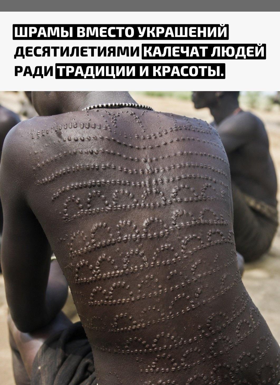 Для ряда африканских народов, включая некоторые общины Эфиопии, скарификация остаётся частью культурной традиции и обряда посвящения