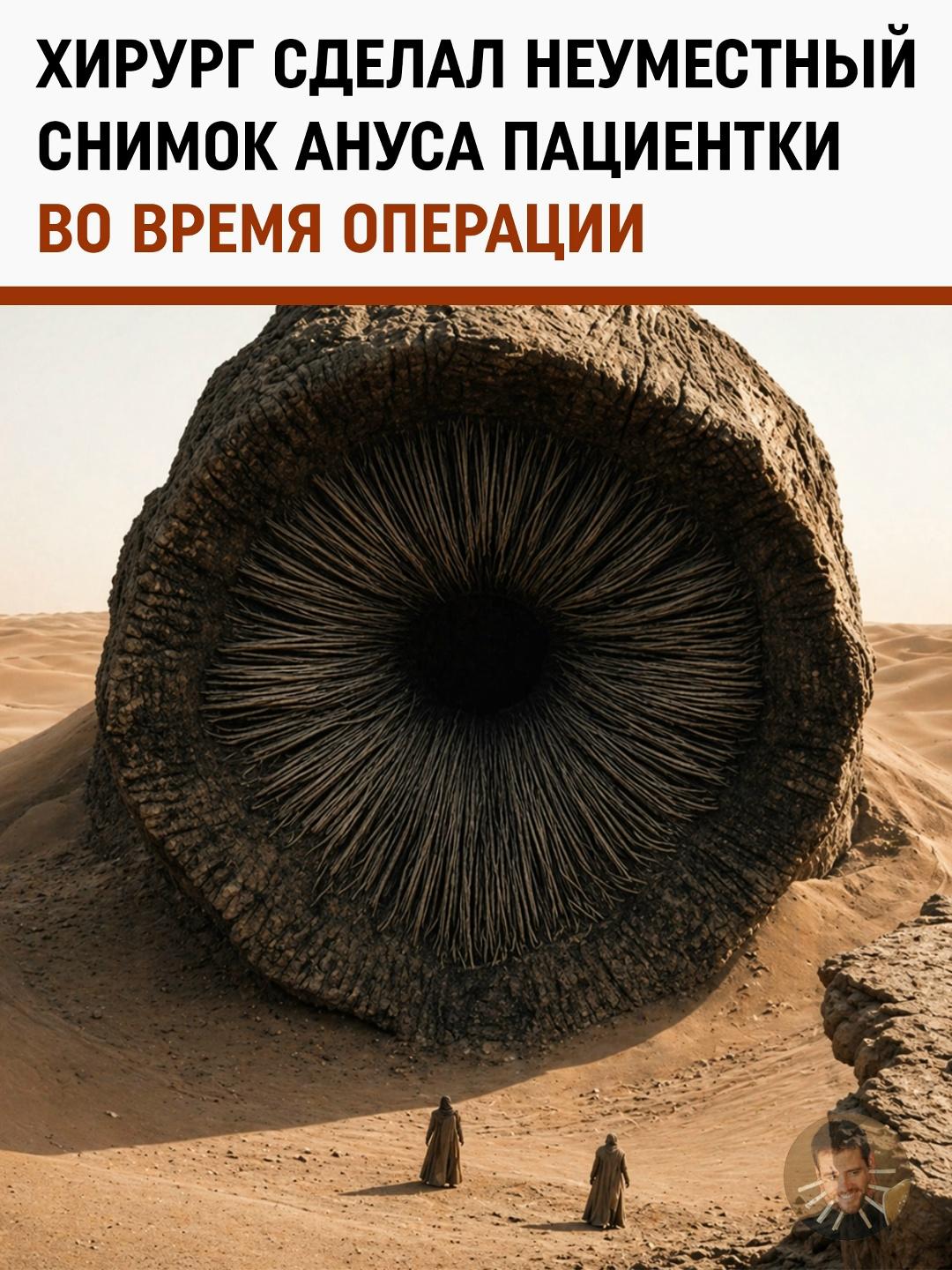 Геморрой вместо грыжи: московская пациентка требует 1,5 млн рублей за снимок на телефоне врача