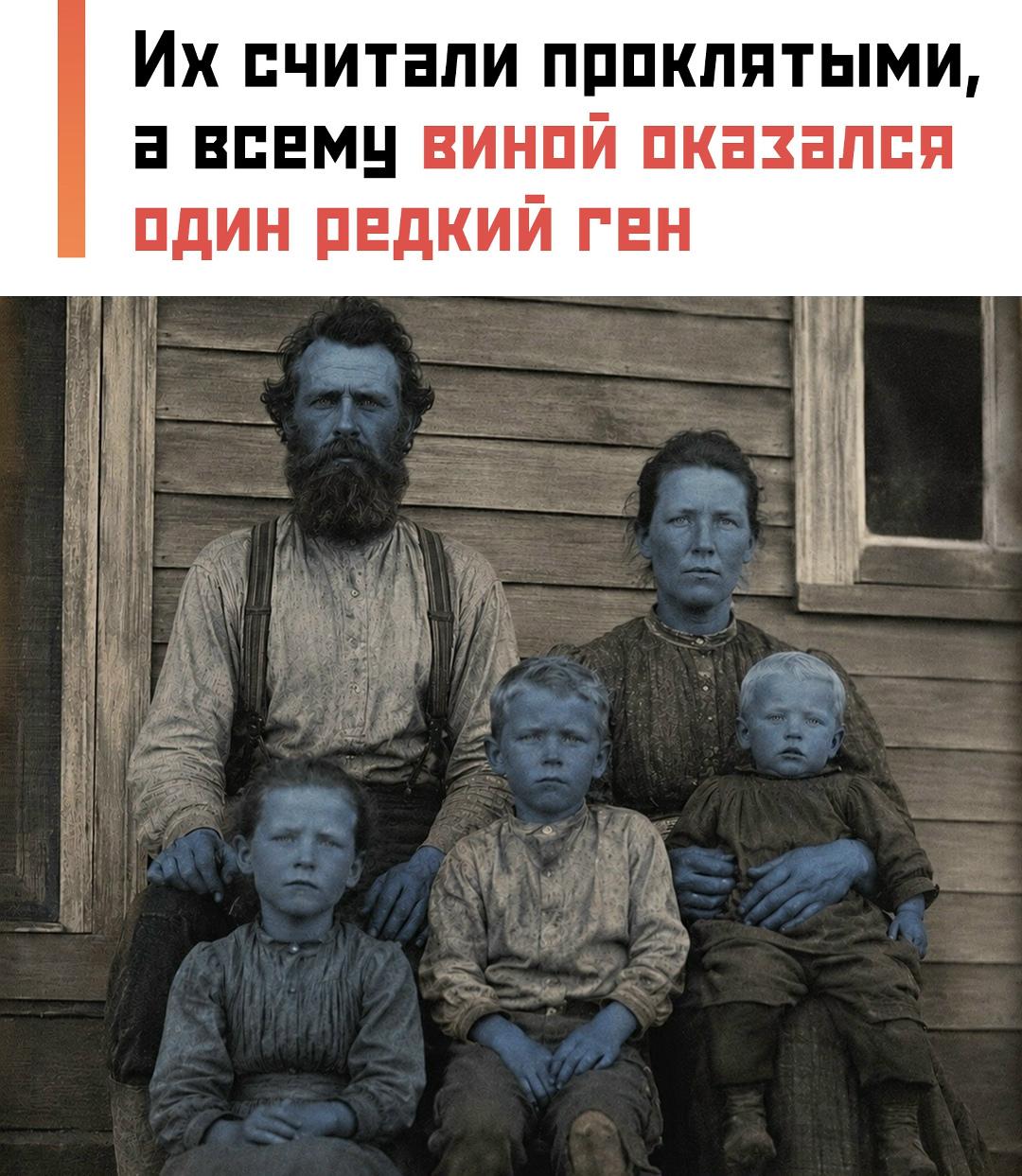 Аватары из Кентукки: как глухая деревня 150 лет плодила реальных синих людей