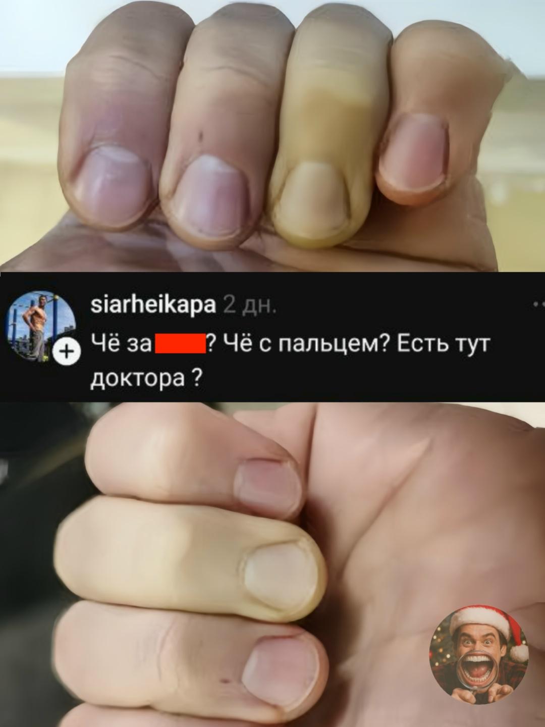 Когда ты просто спросил: «Чё с пальцем?», а в комментариях собрался консилиум века.