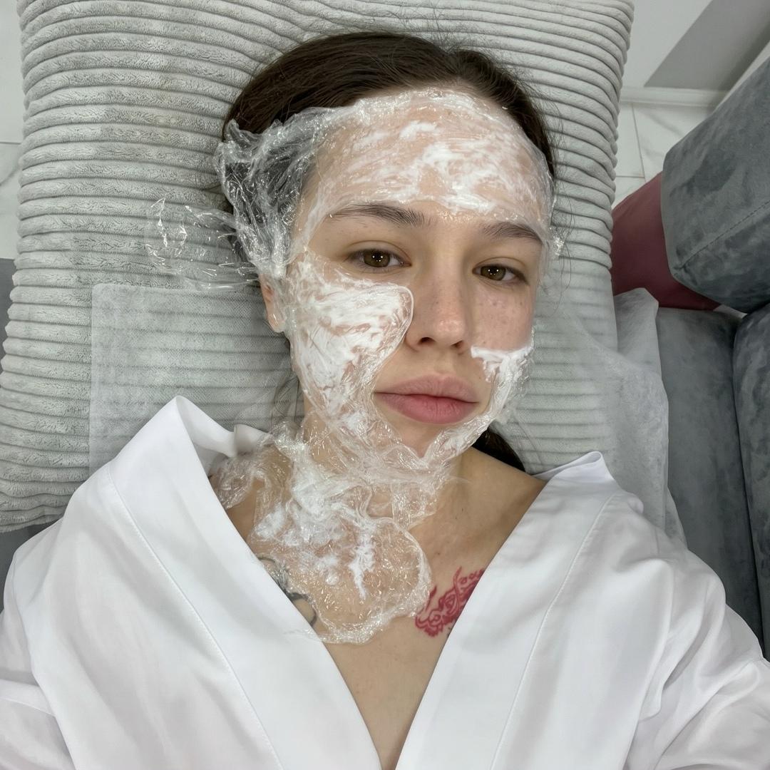 К значимым событиям: Инстасамка поделилась, что увеличила губы