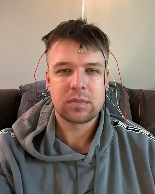 Мужчина с загадочной бессонницей заявил, что не спал два года. Он сменил более 50 врачей, а потом исчез