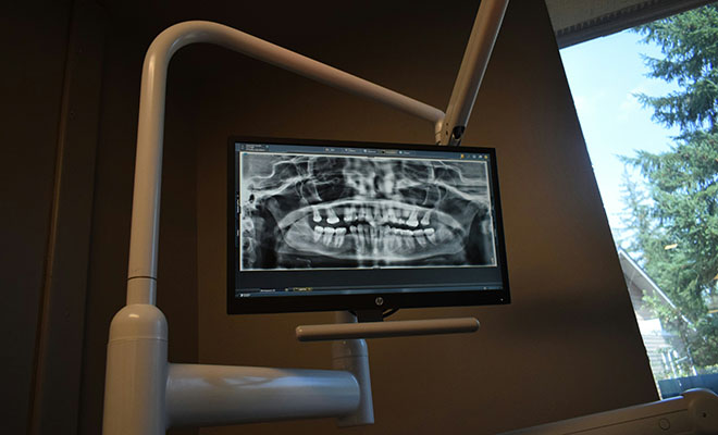 Зубные импланты могут уйти в прошлое. В Японии тестируют прививку, после которой растут новые зубы