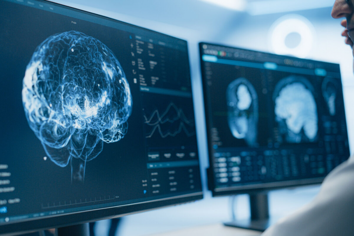 Особенности походки помогают диагностировать смертельно опасные болезни мозга