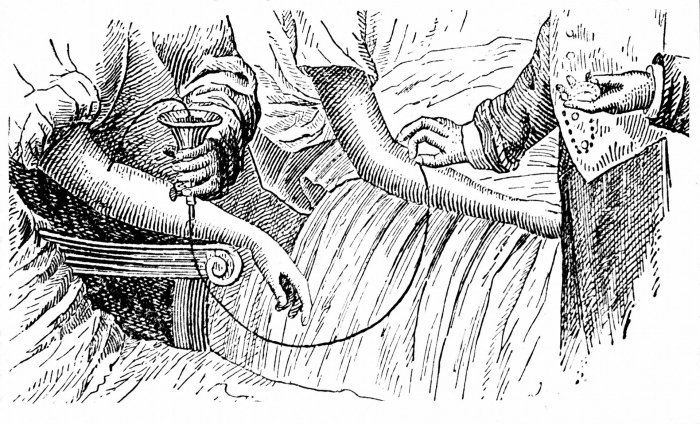 Человечество начало переливать кровь — и вот во что это вылилось