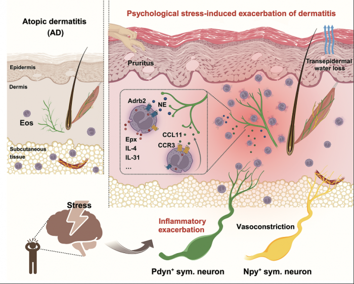 Нейронауки в Science и Nature. Выпуск 329: стресс усугубляет воспаление кожи