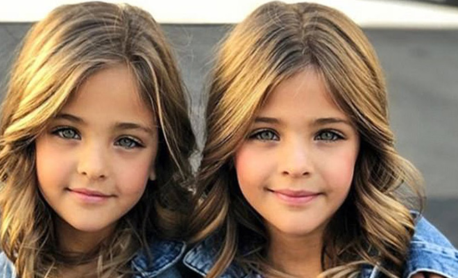 7 лет назад их называли самыми красивыми близняшками: смотрим, какими они стали сейчас