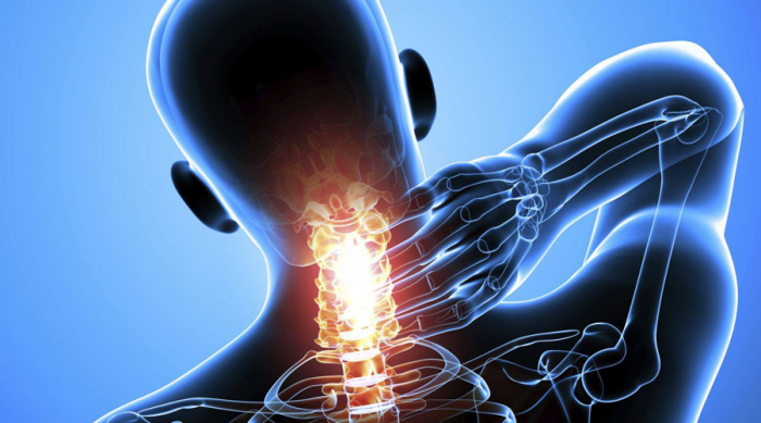 Боль в шее: как ее убрать за 60 секунд