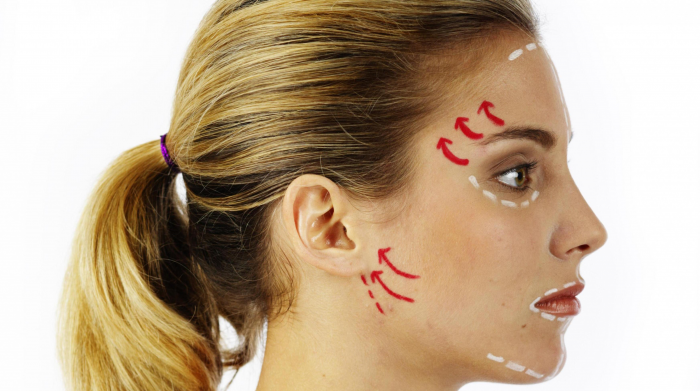 Новое лицо теперь по карману? Как пластические операции превратились из эксклюзива в услугу