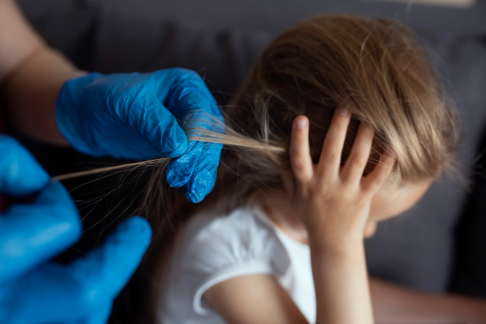 Проверка на вшивость: почему осенью педикулёз выявляют чаще, как распознать у ребёнка и избавиться от паразитов